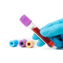 Exámenes+foto+Visiometría+...